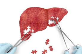 28 июля 2025 года — Всемирный день борьбы с гепатитом