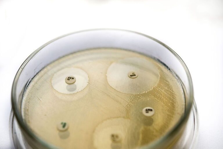 Когда «работает» не все: определение чувствительности к антибиотикам