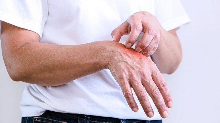 Чесотка её профилактика