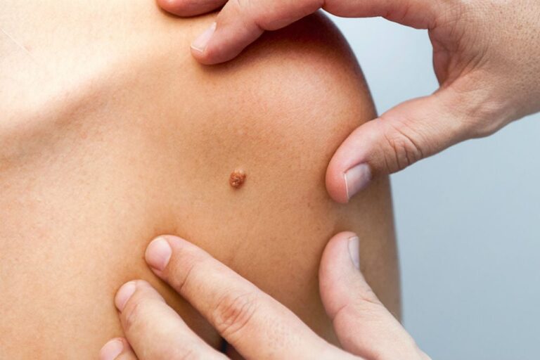 Вакцинация против гриппа и ВПЧ